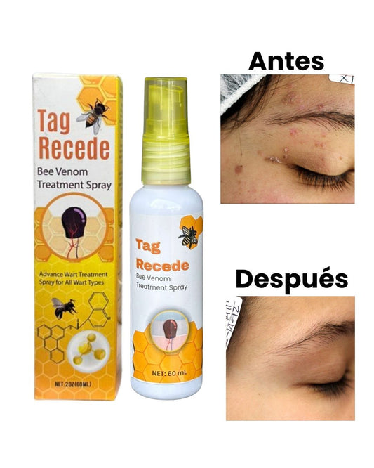 Tag Recede – Piel Lisa y Libre de Verrugas .